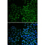 Immunofluorescence - NR0B2 Antibody from Signalway Antibody (32460) - Antibodies.com