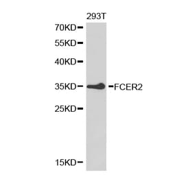 Western blot - FCER2 Antibody from Signalway Antibody (32462) - Antibodies.com