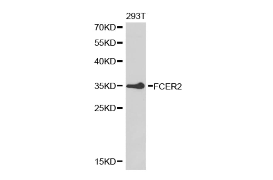 Western blot - FCER2 Antibody from Signalway Antibody (32462) - Antibodies.com