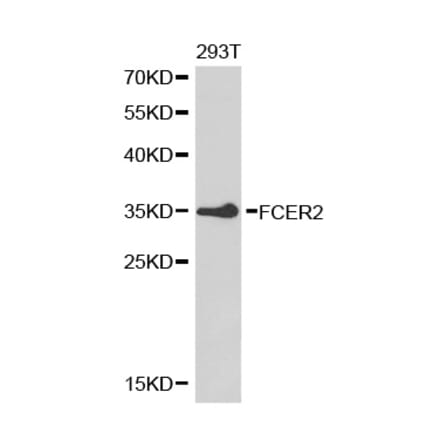 Western blot - FCER2 Antibody from Signalway Antibody (32462) - Antibodies.com