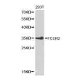 Western blot - FCER2 Antibody from Signalway Antibody (32462) - Antibodies.com