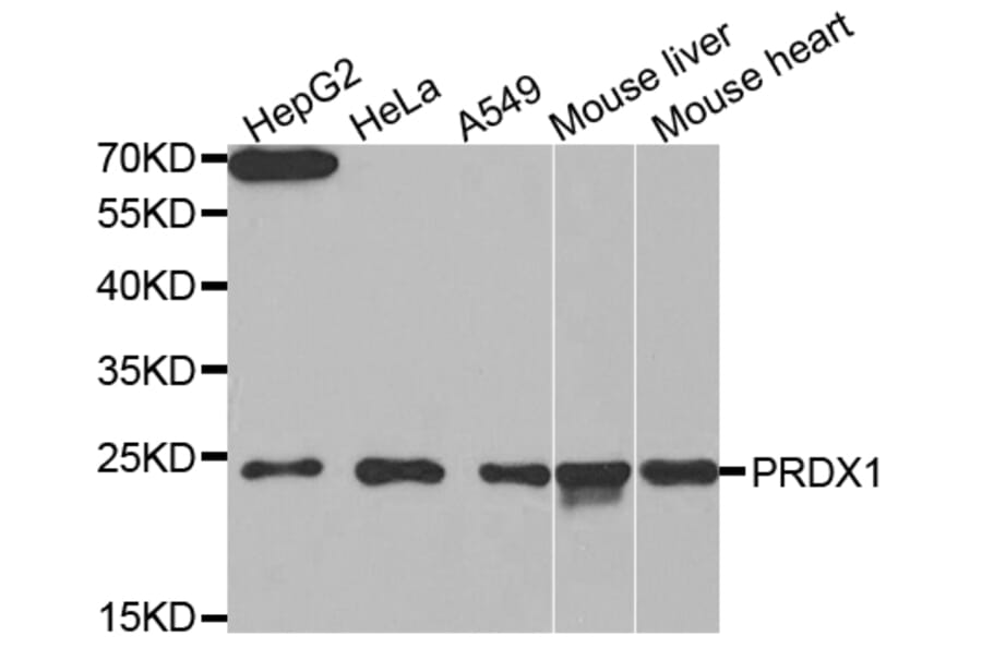 Western blot - PRDX1 Antibody from Signalway Antibody (32463) - Antibodies.com