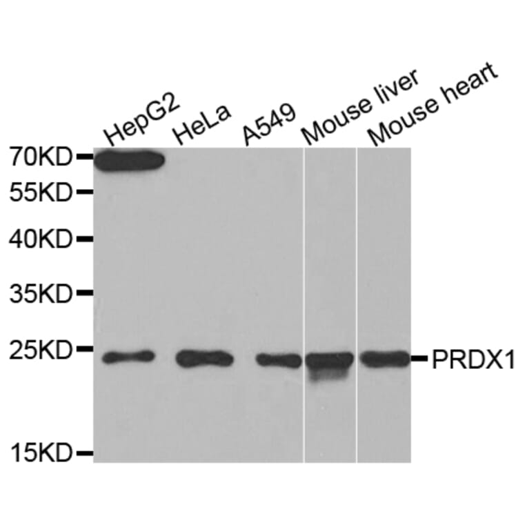 Western blot - PRDX1 Antibody from Signalway Antibody (32463) - Antibodies.com