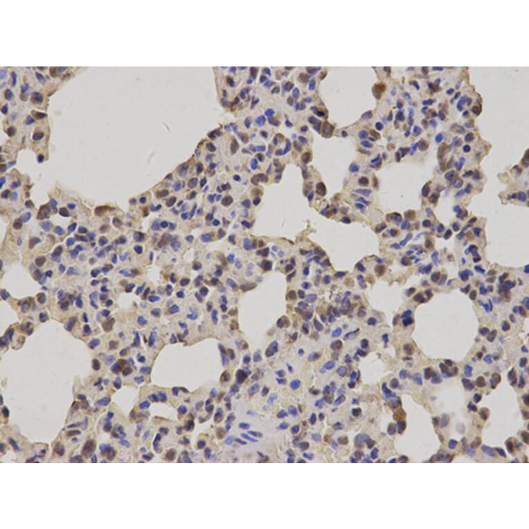Immunohistochemistry - PRDX1 Antibody from Signalway Antibody (32463) - Antibodies.com