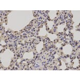 Immunohistochemistry - PRDX1 Antibody from Signalway Antibody (32463) - Antibodies.com