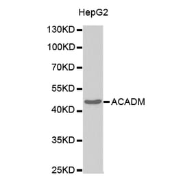 Western blot - ACADM Antibody from Signalway Antibody (32482) - Antibodies.com
