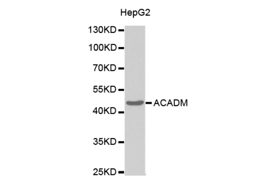 Western blot - ACADM Antibody from Signalway Antibody (32482) - Antibodies.com