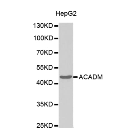 Western blot - ACADM Antibody from Signalway Antibody (32482) - Antibodies.com