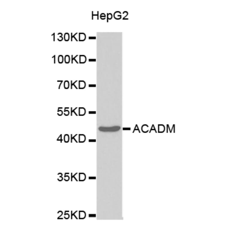 Western blot - ACADM Antibody from Signalway Antibody (32482) - Antibodies.com