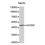 Western blot - ACADM Antibody from Signalway Antibody (32482) - Antibodies.com