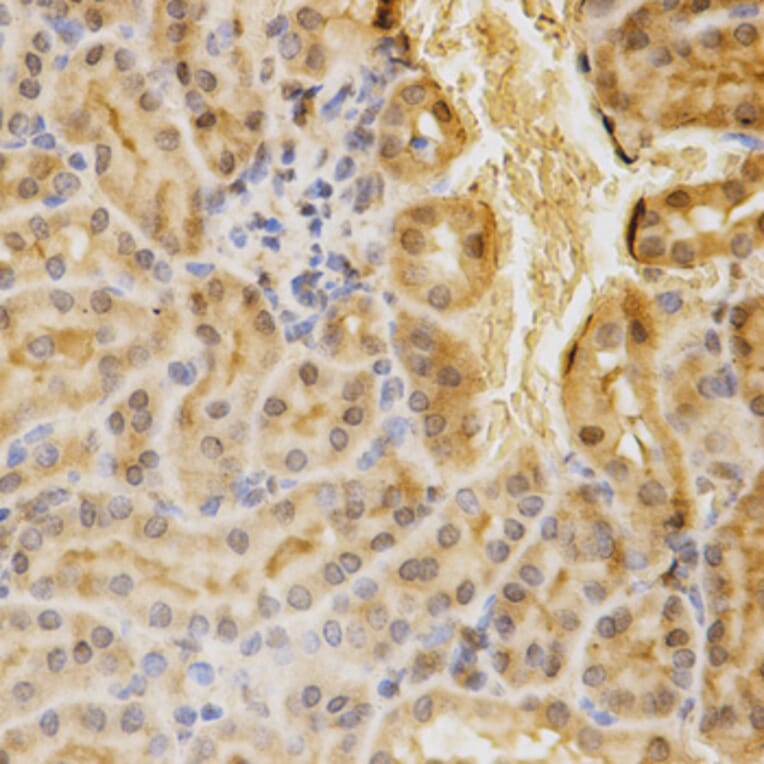 Immunohistochemistry - ACADM Antibody from Signalway Antibody (32482) - Antibodies.com