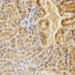 Immunohistochemistry - ACADM Antibody from Signalway Antibody (32482) - Antibodies.com