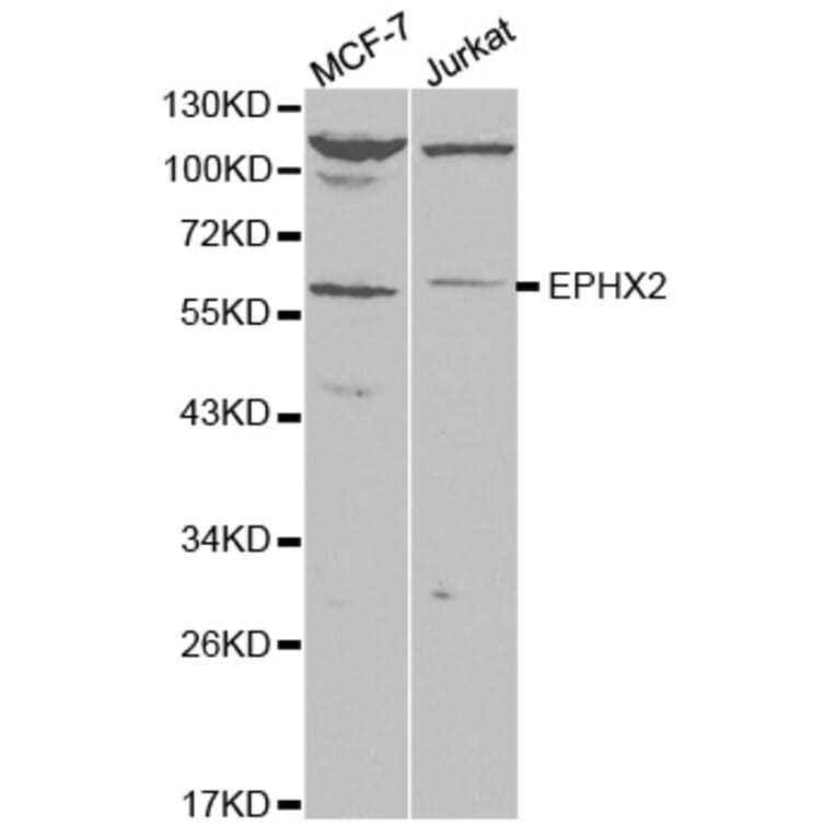Western blot - EPXH2 Antibody from Signalway Antibody (32486) - Antibodies.com