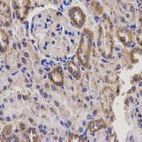Immunohistochemistry - EPXH2 Antibody from Signalway Antibody (32486) - Antibodies.com