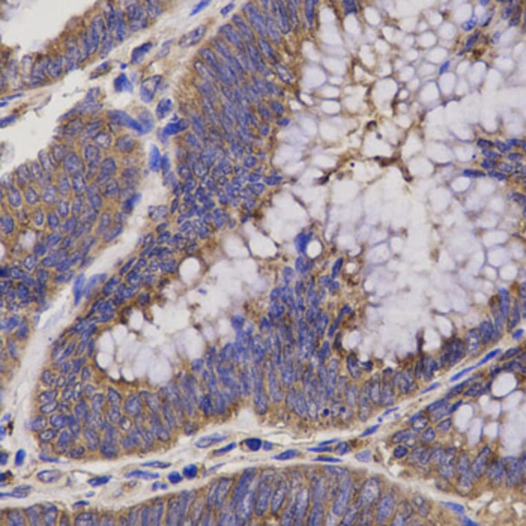 Immunohistochemistry - EPXH2 Antibody from Signalway Antibody (32486) - Antibodies.com