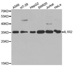 Western blot - IL1R2 Antibody from Signalway Antibody (32490) - Antibodies.com