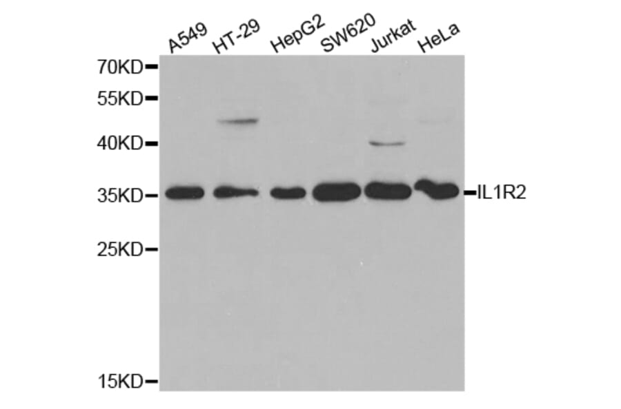 Western blot - IL1R2 Antibody from Signalway Antibody (32490) - Antibodies.com