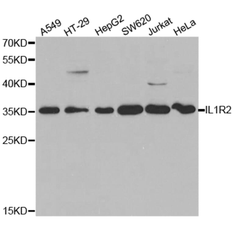 Western blot - IL1R2 Antibody from Signalway Antibody (32490) - Antibodies.com