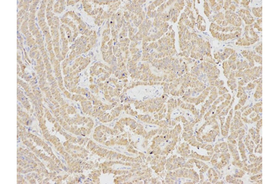 Immunohistochemistry - IL1R2 Antibody from Signalway Antibody (32490) - Antibodies.com