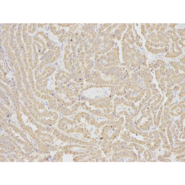 Immunohistochemistry - IL1R2 Antibody from Signalway Antibody (32490) - Antibodies.com