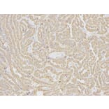 Immunohistochemistry - IL1R2 Antibody from Signalway Antibody (32490) - Antibodies.com