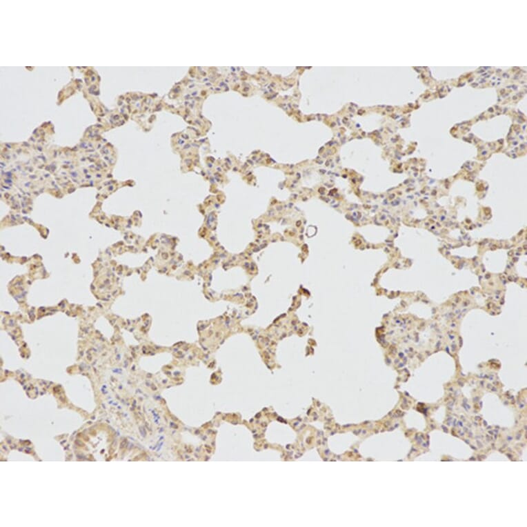 Immunohistochemistry - IL1R2 Antibody from Signalway Antibody (32490) - Antibodies.com