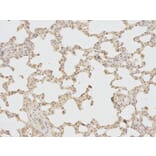 Immunohistochemistry - IL1R2 Antibody from Signalway Antibody (32490) - Antibodies.com