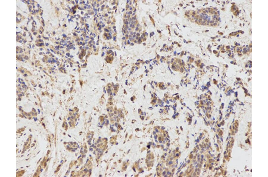 Immunohistochemistry - IL1R2 Antibody from Signalway Antibody (32490) - Antibodies.com