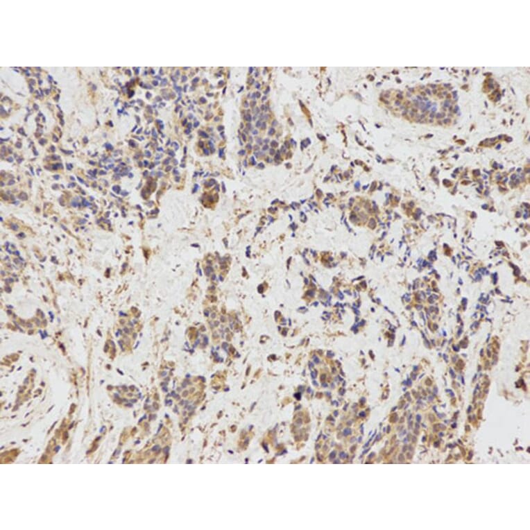 Immunohistochemistry - IL1R2 Antibody from Signalway Antibody (32490) - Antibodies.com