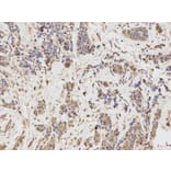 Immunohistochemistry - IL1R2 Antibody from Signalway Antibody (32490) - Antibodies.com