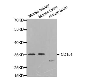 Western blot - CD151 Antibody from Signalway Antibody (32504) - Antibodies.com
