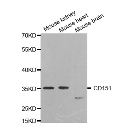 Western blot - CD151 Antibody from Signalway Antibody (32504) - Antibodies.com