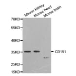 Western blot - CD151 Antibody from Signalway Antibody (32504) - Antibodies.com