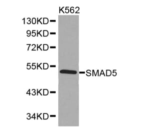 Western blot - SMAD5 Antibody from Signalway Antibody (32514) - Antibodies.com