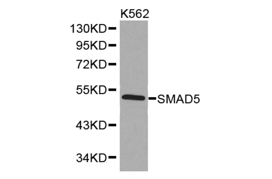Western blot - SMAD5 Antibody from Signalway Antibody (32514) - Antibodies.com