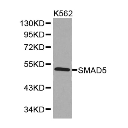 Western blot - SMAD5 Antibody from Signalway Antibody (32514) - Antibodies.com