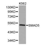 Western blot - SMAD5 Antibody from Signalway Antibody (32514) - Antibodies.com