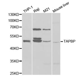 Western blot - TAPBP Antibody from Signalway Antibody (32525) - Antibodies.com