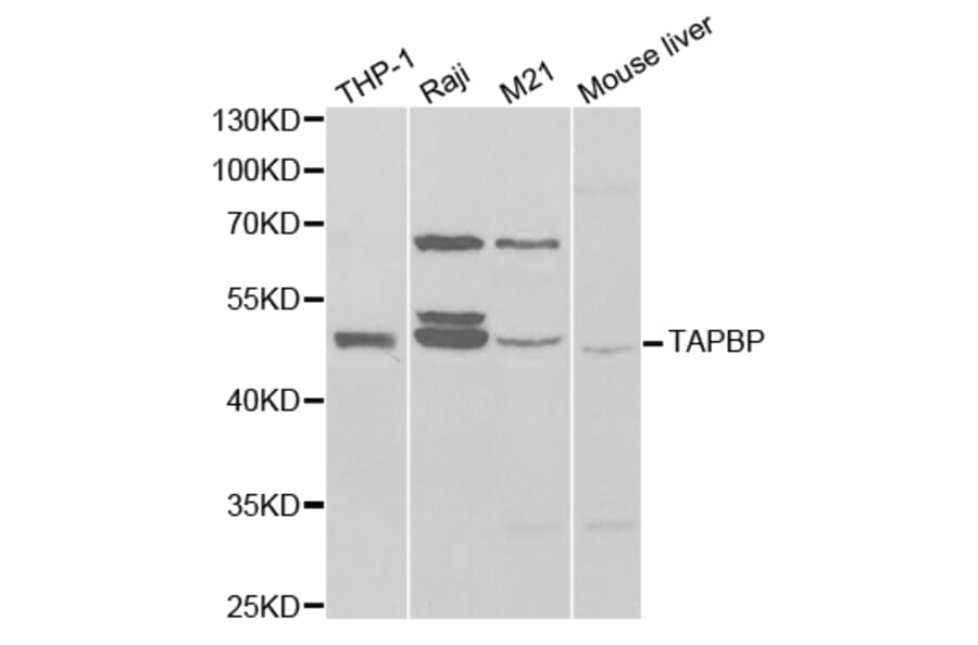 Western blot - TAPBP Antibody from Signalway Antibody (32525) - Antibodies.com