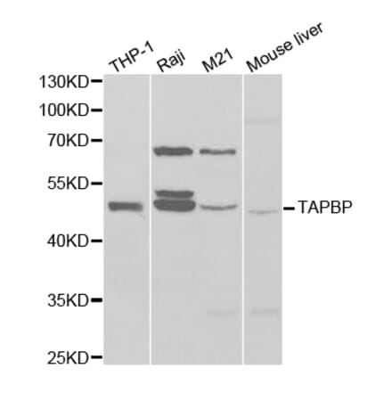 Western blot - TAPBP Antibody from Signalway Antibody (32525) - Antibodies.com