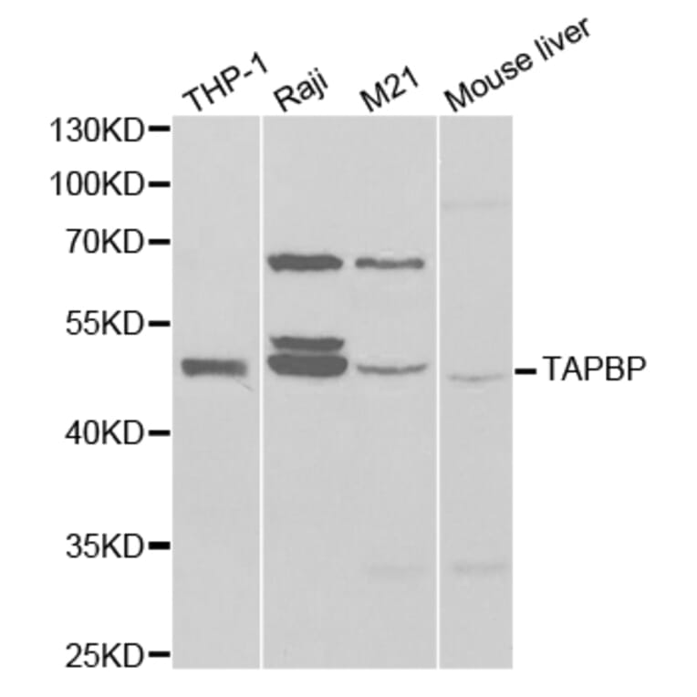 Western blot - TAPBP Antibody from Signalway Antibody (32525) - Antibodies.com