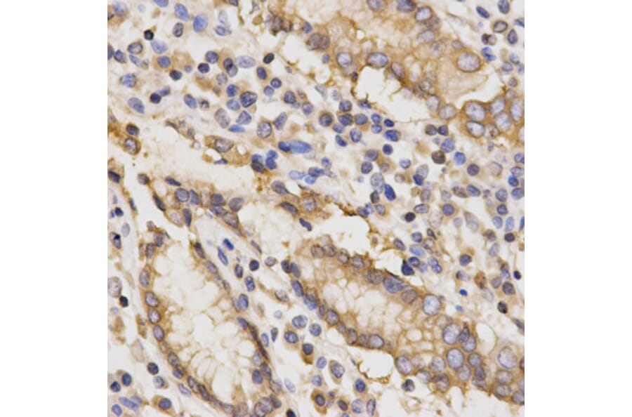 Immunohistochemistry - TAPBP Antibody from Signalway Antibody (32525) - Antibodies.com