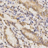 Immunohistochemistry - TAPBP Antibody from Signalway Antibody (32525) - Antibodies.com
