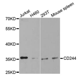 Western blot - CD244 Antibody from Signalway Antibody (32541) - Antibodies.com