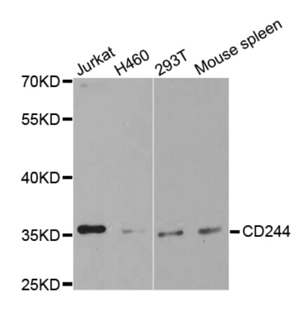Western blot - CD244 Antibody from Signalway Antibody (32541) - Antibodies.com