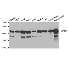 Western blot - AP2B1 Antibody from Signalway Antibody (32542) - Antibodies.com