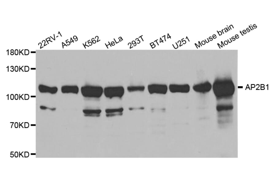 Western blot - AP2B1 Antibody from Signalway Antibody (32542) - Antibodies.com