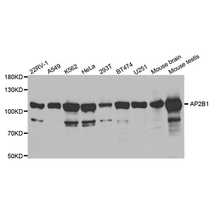 Western blot - AP2B1 Antibody from Signalway Antibody (32542) - Antibodies.com