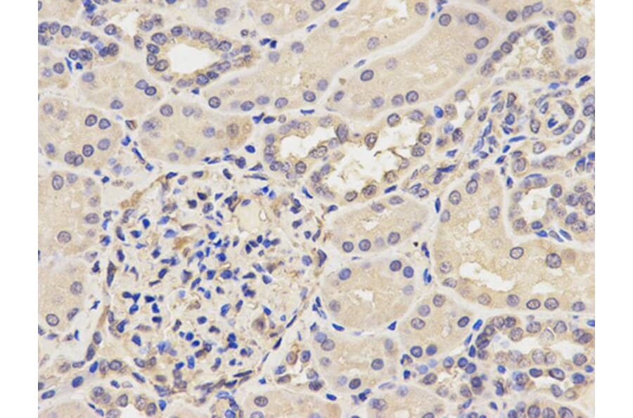 Immunohistochemistry - AP2B1 Antibody from Signalway Antibody (32542) - Antibodies.com