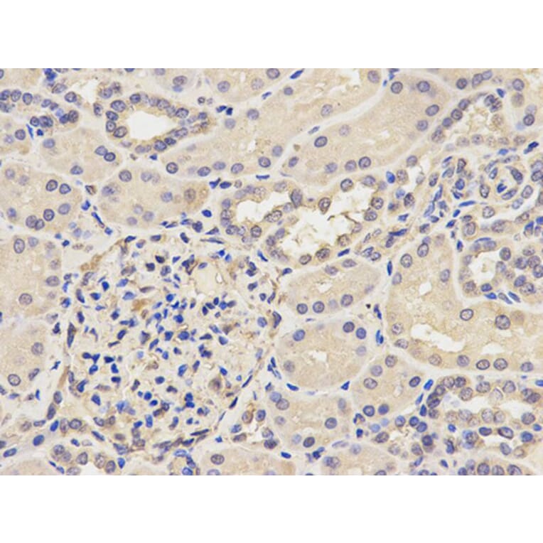 Immunohistochemistry - AP2B1 Antibody from Signalway Antibody (32542) - Antibodies.com
